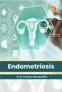 Image of Endometriosis